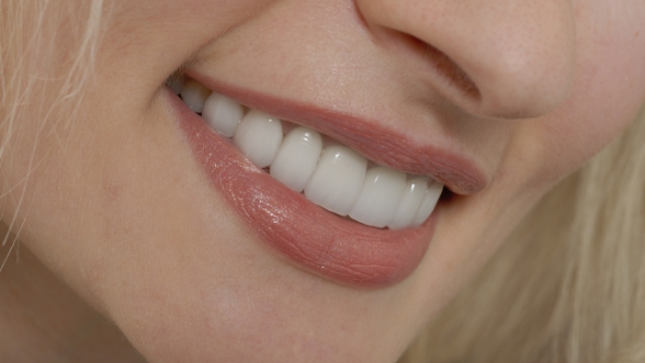 Close up of woman with straight white teeth smiling