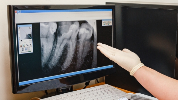 Dentist pointing to computer monitor showing digital x rays of teeth
